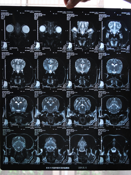 MRI画像.jpg